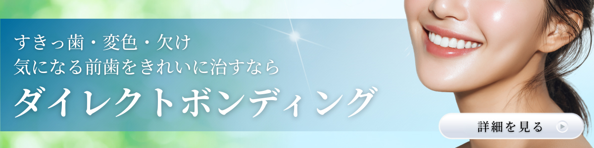 ダイレクトボンディング